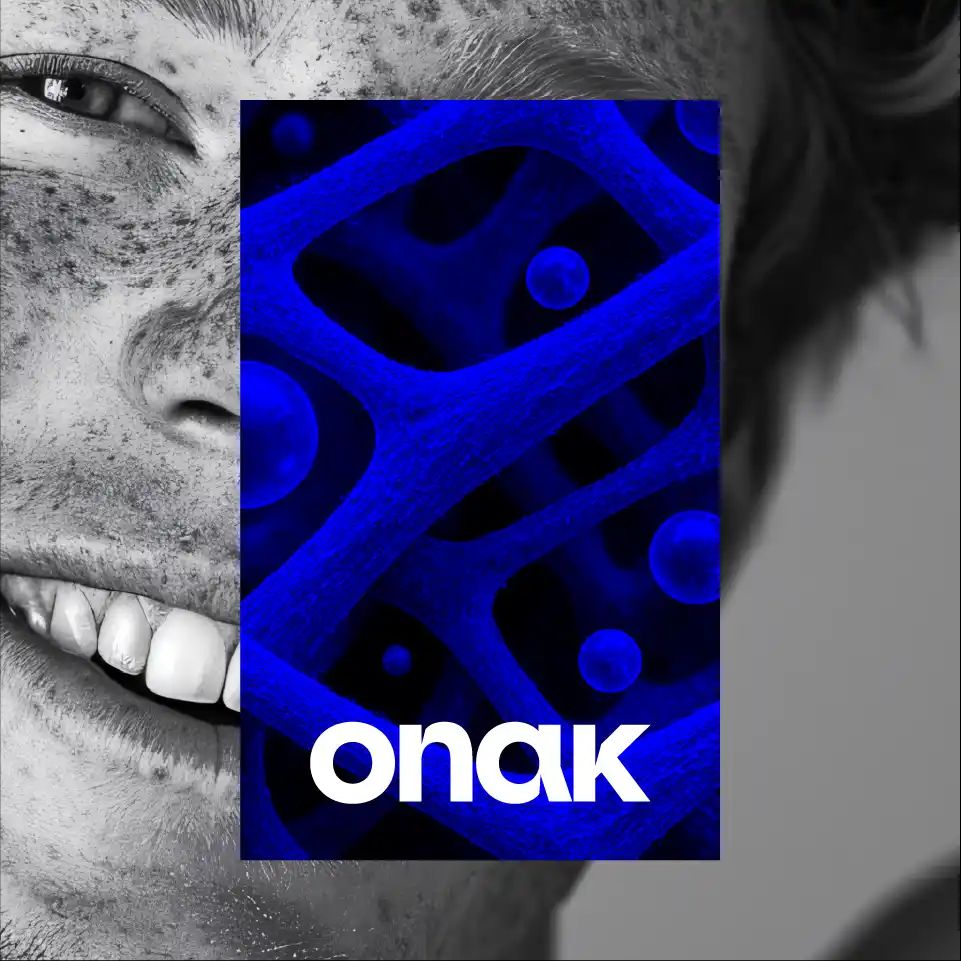 Imagen de IMG ONAK AT 15 11zon