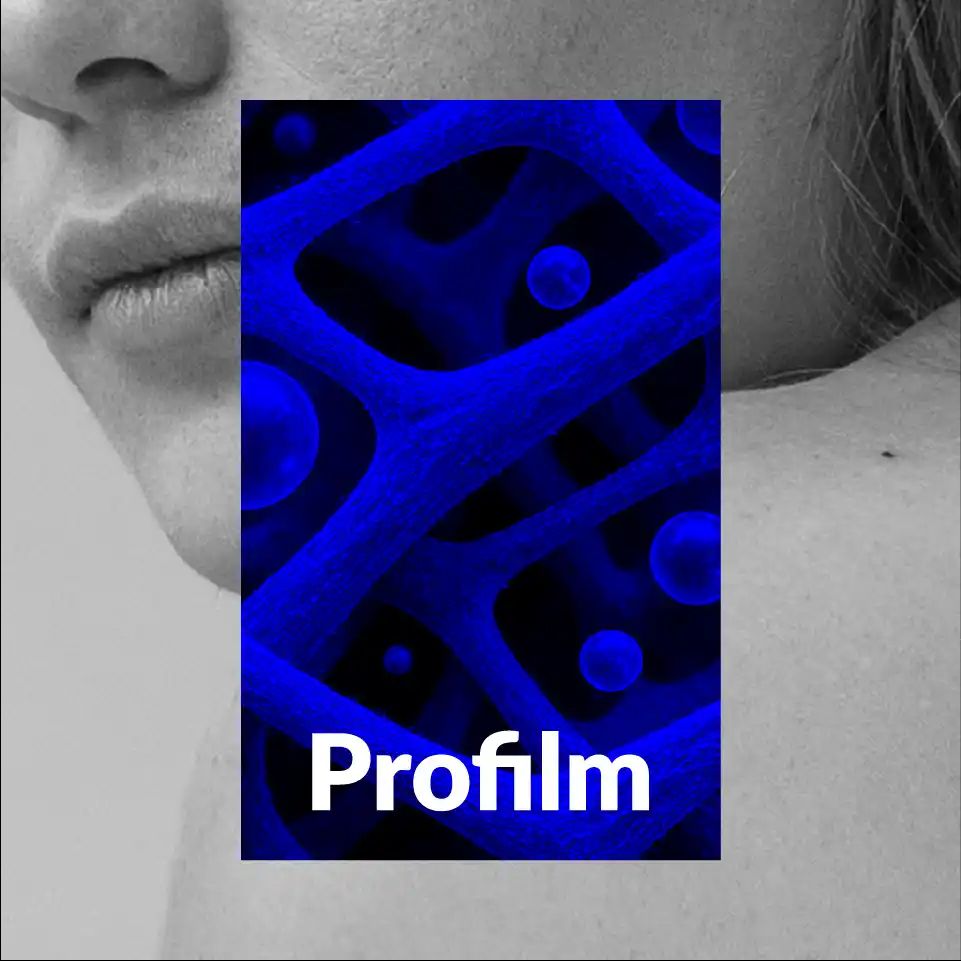 Imagen de IMG PROFILM AT 1 11zon