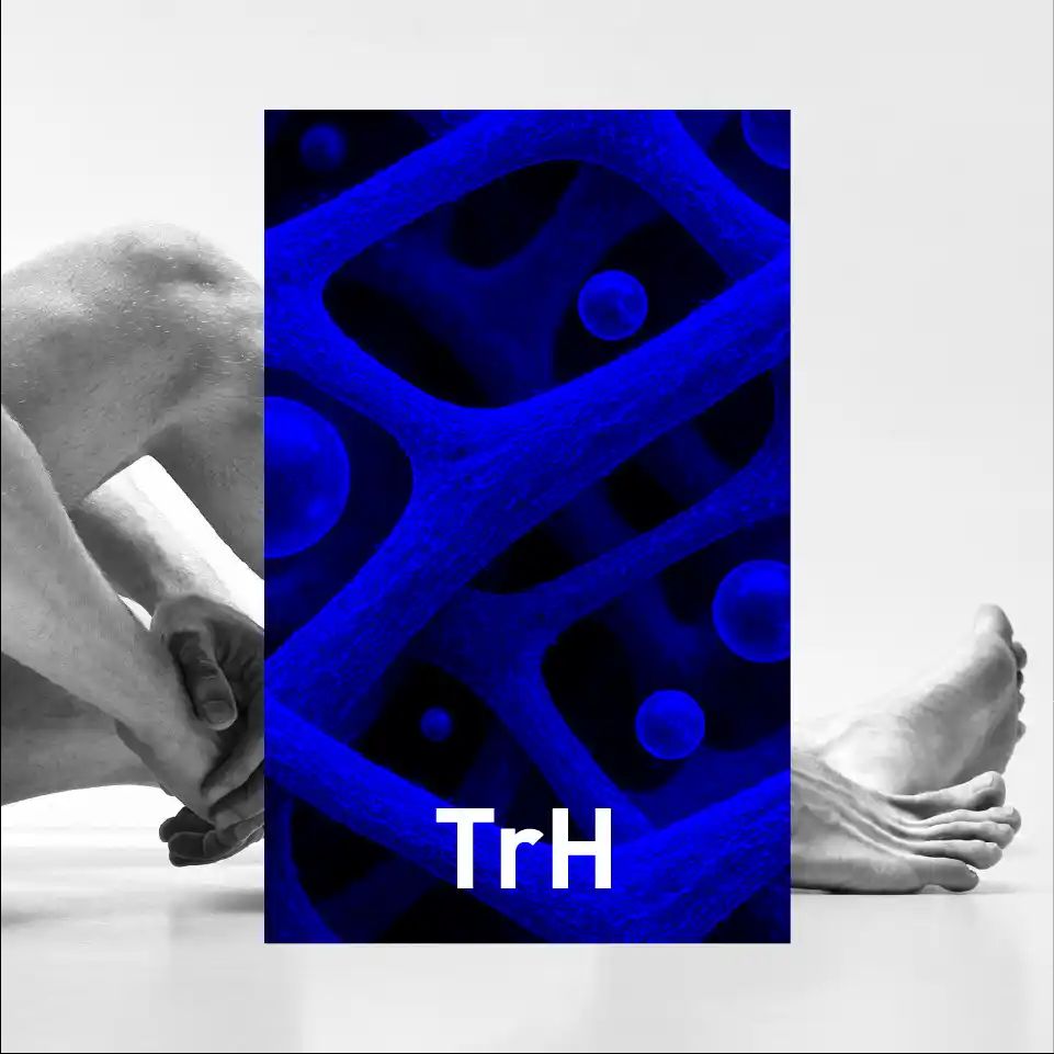 Imagen de IMG TrH AT 3 11zon